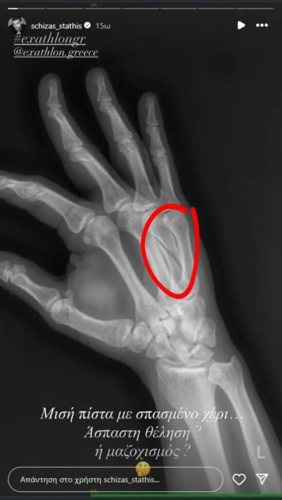 stathis sxizas anartisi spasmeno xeri